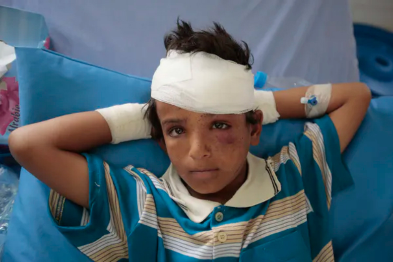 a-child-injured-in-a-deadly-saudi-led-coalition-airstrike